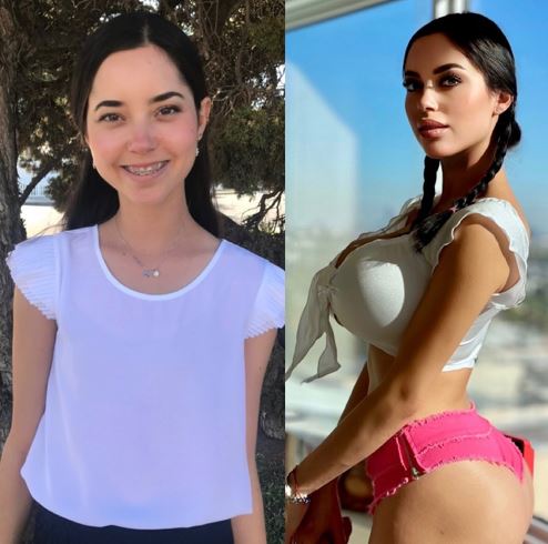 Marisol Yotta before and after surgery